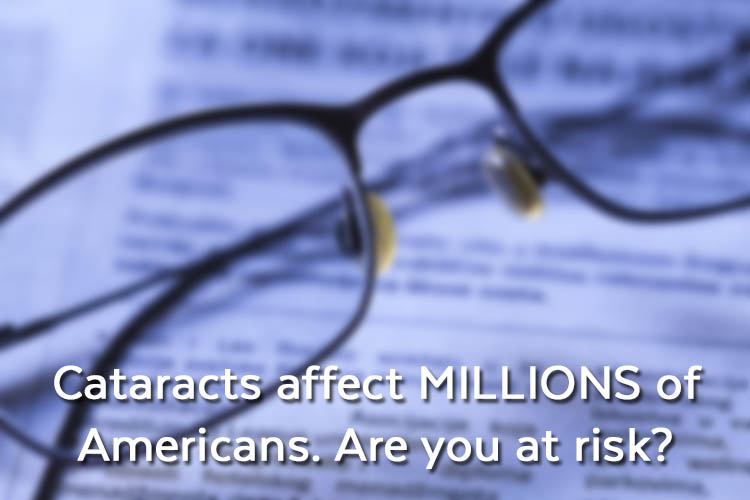 cataract risk factors
