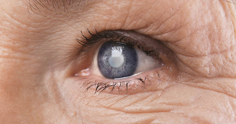 Age-Related Eye Diseases